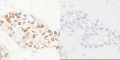 Immunohistochemistry-Paraffin: PCNA [p Tyr211] Antibody [NB100-59861]
